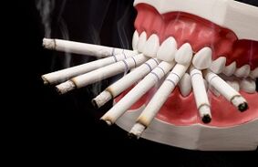 È possibile fumare dopo una descrizione del dente
